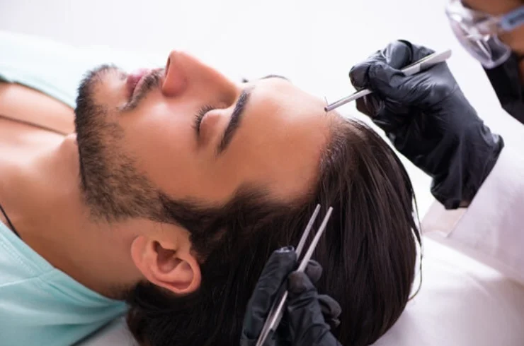 hair restoration